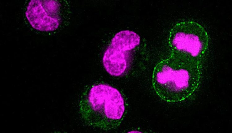 Лизосомную активность можно увидеть зеленым цветом на этих изображениях клеток, очищающих свои отходы