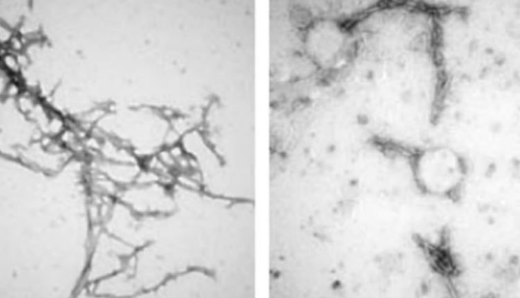Лечение нанотелами может помочь очистить мозг от белковых скоплений при болезни Паркинсона