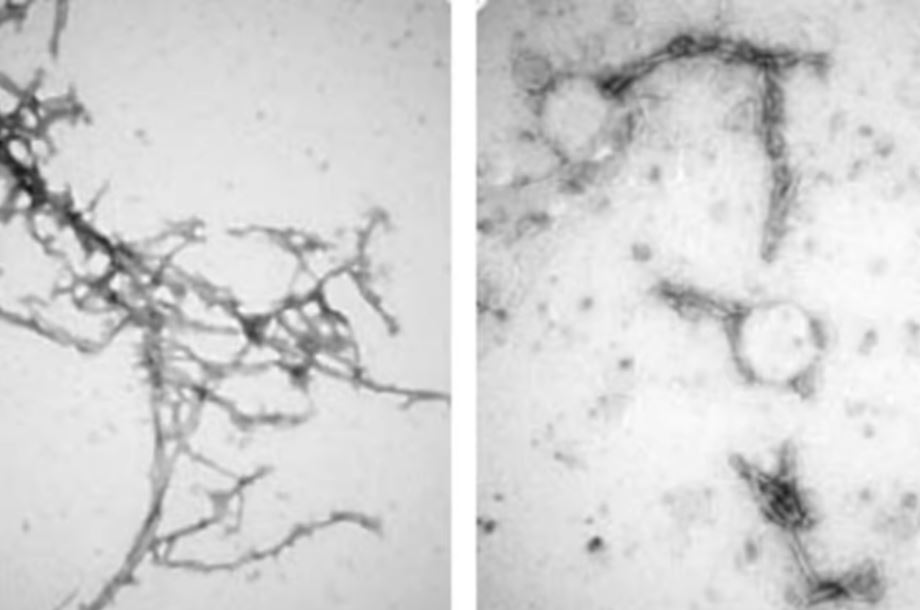 Лечение нанотелами может помочь очистить мозг от белковых скоплений при болезни Паркинсона