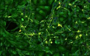 Нейроны гиппокампа (желтые), окруженные астроцитами (зеленые) в культуре клеток из исследования