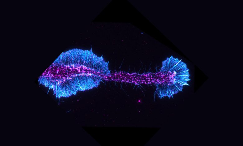 Актиновые нити (голубой) и регуляторный белок актина (пурпурный) в дифференцирующемся олигодендроците.