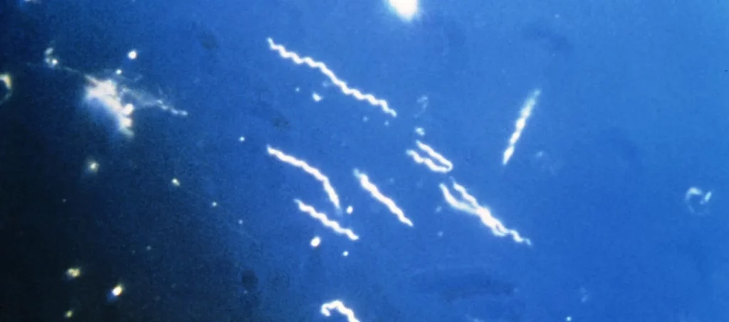 Borrelia burgdorfer