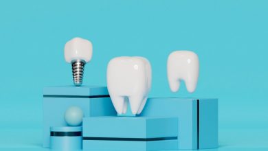 Лучшие протетические компоненты для зубных имплантатов