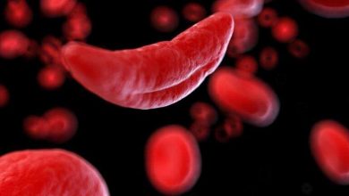 Возможное лечение серповидноклеточной анемии